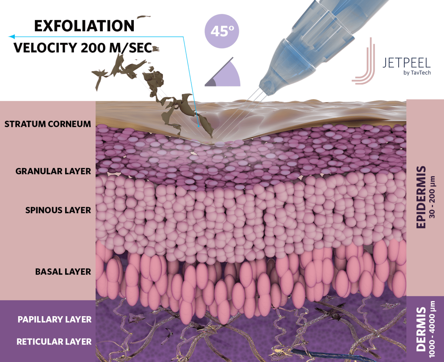 JetPeel ексфолиация